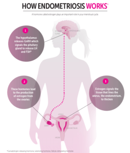 how-endometriosis-works-poster